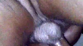 chocolate glazed in hospital setting