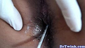 I love how this Asian doctor plays with twink's tight ass!