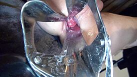 Pretty Nurse Dominates with Huge Speculum in Wild Anal Play