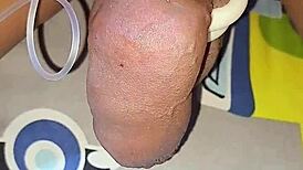 Myanmar Gay Cocklover Explores Monster Cock In Homemade Saline Injection