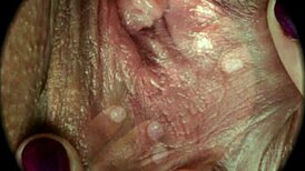 Close-Up of Hairy Pussy in HD Sex Textures by Rumesco