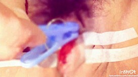 Clit sucking and pinching with an electric massage for a gay orgasm