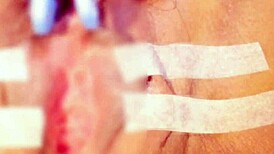 Clit sucking and pinching with an electric massage for a gay orgasm