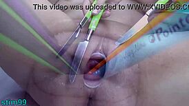 Two lesbians perform extreme prolapse insertions at the same time