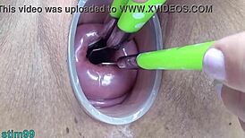 Two lesbians perform extreme prolapse insertions at the same time