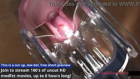 Miss Mars conducts human guinea pig experiments in hospital