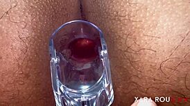 Detailed anal examination with speculum reveals tight, gaping asshole of mature BBW slut