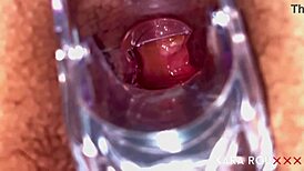 Detailed anal examination with speculum reveals tight, gaping asshole of mature BBW slut